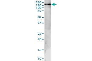 Immunoprecipitation (IP) image for anti-General Transcription Factor II I Repeat Domain-Containing 1 (GTF2IRD1) (AA 1-959) antibody (ABIN523046)