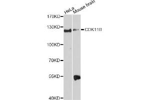Western blot analysis of extracts of various cell lines, using CDK11B Antibody. (CDK11 抗体)
