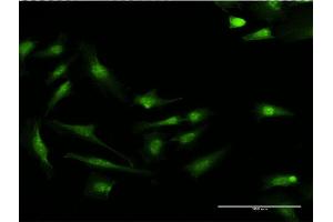 Immunofluorescence of monoclonal antibody to S100P on HeLa cell. (S100P 抗体  (AA 1-95))