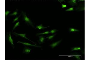 Immunofluorescence of monoclonal antibody to S100P on HeLa cell. (S100P 抗体  (AA 1-95))