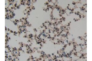 DAB staining on IHC-P; Samples: Mouse Lung Tissue (CASP14 抗体  (AA 17-248))