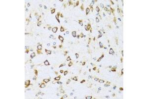 Immunohistochemistry of paraffin-embedded mouse brain using NRG4 antibody at dilution of 1:100 (40x lens). (Neuregulin 4 抗体)