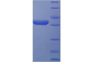 SDS-PAGE (SDS) image for Density-Regulated Protein (DENR) (AA 2-198) protein (His-SUMO Tag) (ABIN5709397) (Density Regulated Protein Protein (AA 2-198) (His-SUMO Tag))