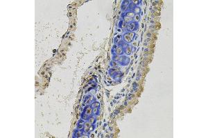 Immunohistochemistry of paraffin-embedded mouse lung using INHBB antibody at dilution of 1:100 (x40 lens). (INHBB 抗体)
