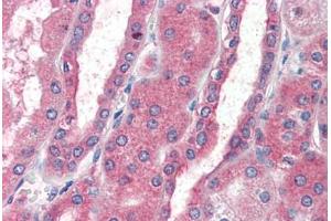 Human Kidney (formalin-fixed, paraffin-embedded) stained with CXCR4 antibody ABIN461996 at 5 ug/ml followed by biotinylated anti-goat IgG secondary antibody ABIN481715, alkaline phosphatase-streptavidin and chromogen. (CXCR4 抗体  (AA 14-40))