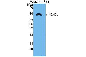 Western blot analysis of the recombinant protein. (TPM2 抗体  (AA 1-284))