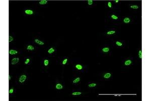 Immunofluorescence of monoclonal antibody to PTPN22 on HeLa cell. (PTPN22 抗体  (AA 10-113))