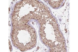 ABIN6266521 at 1/200 staining human testis tissue sections by IHC-P. (Cullin 2 抗体  (C-Term))
