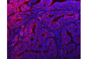 IF analysis of TOMM40 using anti-TOMM40 antibody (ABIN7599738).