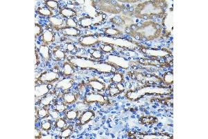 Immunohistochemistry of paraffin-embedded mouse kidney using TTC11/FIS1 antibody (ABIN7267209) at dilution of 1:100 (40x lens).