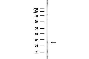 anti-Frequently Rearranged in Advanced T-Cell Lymphomas (FRAT1) (C-Term) antibody