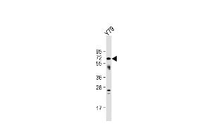Anti-NEURL Antibody (Center) at 1:1000 dilution + Y79 whole cell lysate Lysates/proteins at 20 μg per lane.