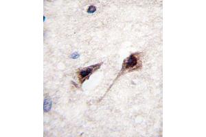 Formalin-fixed and paraffin-embedded human brain tissue reacted with MEF2C Antibody  (ABIN390244 and ABIN2840710) , which was peroxidase-conjugated to the secondary antibody, followed by DAB staining. (MEF2C 抗体  (AA 365-394))