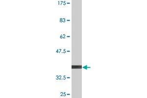 Western Blot detection against Immunogen (36. (PIK3R4 抗体  (AA 1259-1358))