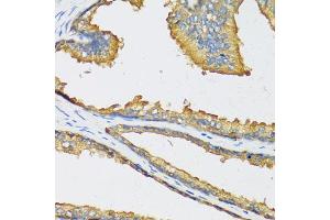 Immunohistochemistry of paraffin-embedded human prostate using CXCL11 antibody. (CXCL11 抗体)