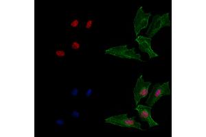 ABIN6265200 and ABIN6269069 staining  cells by IF/ICC. (SNAIL 抗体  (C-Term))