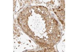 Immunohistochemical staining of human testis with SGSM1 polyclonal antibody  shows strong cytoplasmic positivity in cells in seminiferus ducts and moderate in Leydig cells at 1:10-1:20 dilution. (SGSM1 抗体)