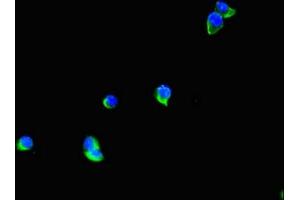 Immunofluorescent analysis of Hela cells using ABIN7171701 at dilution of 1:100 and Alexa Fluor 488-congugated AffiniPure Goat Anti-Rabbit IgG(H+L)