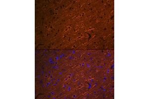 Immunofluorescence analysis of rat brain using βIII-Tubulin/β3-Tubulin Rabbit mAb (ABIN7271049) at dilution of 1:100 (40x lens). (TUBB3 抗体)