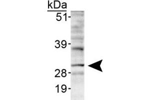 Western blot analysis of INSIG1 in HepG2 lyaste using INSIG1 polyclonal antibody . (INSIG1 抗体  (AA 1-100))