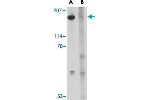 Western blot analysis of SLITRK5 in NIH/3T3 cell lysate with SLITRK5 polyclonal antibody  at 1 ug/mL in the (A) absence or (B) presence of blocking peptide. (SLITRK5 抗体  (Internal Region))