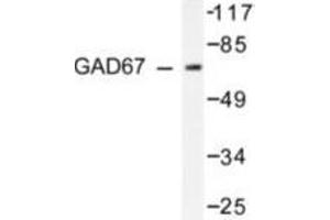 Image no. 2 for anti-Glutamate Decarboxylase 1 (Brain, 67kDa) (GAD1) antibody (ABIN265428) (GAD 抗体)
