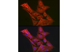 Immunofluorescence analysis of NIH-3T3 cells using GART Rabbit pAb (ABIN1679954, ABIN3018225, ABIN3018226 and ABIN6220407) at dilution of 1:200 (40x lens). (GART 抗体  (AA 1-320))