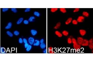 Immunofluorescence analysis of 293T cells using DiMethyl-Histone H3-K27 antibody. (Histone 3 抗体  (H3K27me))