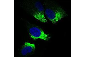 Immunofluorescence analysis of Hela cells using TWIST1 mouse mAb (green). (TWIST1 抗体  (AA 9-74))