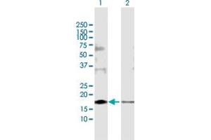 Western Blot analysis of SDCBP expression in transfected 293T cell line by SDCBP MaxPab polyclonal antibody. (SDCBP 抗体  (AA 1-298))