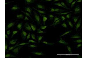 Immunofluorescence of monoclonal antibody to PTTG1 on HeLa cell. (PTTG1 抗体  (AA 93-113))