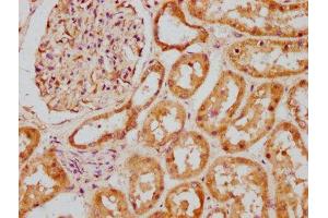 IHC image of ABIN7145242 diluted at 1:200 and staining in paraffin-embedded human kidney tissue performed on a Leica BondTM system.
