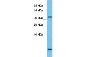 Western Blotting (WB) image for anti-Aconitase 1 (ACO1) (N-Term) antibody (ABIN2778793)