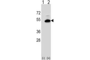 Western Blotting (WB) image for anti-Sphingomyelin Synthase 2 (SGMS2) antibody (ABIN3004297) (Sphingomyelin Synthase 2 抗体)
