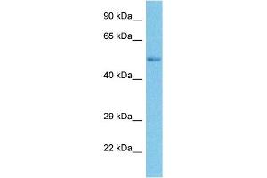 Host:  Rabbit  Target Name:  SMYD3  Sample Tissue:  Human Ovary Tumor  Antibody Dilution:  1ug/ml (SMYD3 抗体  (N-Term))