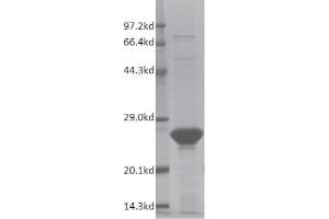 SMARCA2 Protein (AA 1367-1511) (His tag,DYKDDDDK Tag)