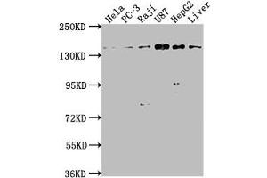 Western Blot Positive WB detected in: Hela whole cell lysate, PC-3 whole cell lysate, Raji whole cell lysate, U87 whole cell lysate, HepG2 whole cell lysate, Mouse liver tissue All lanes: MAP4K4 antibody at 1:1000 Secondary Goat polyclonal to rabbit IgG at 1/50000 dilution Predicted band size: 143, 139, 151, 134, 142, 146 kDa Observed band size: 143 kDa (MAP4K4 抗体  (AA 866-1104))