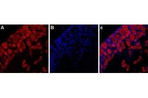 Expression of P2RX3 in rat DRG - Immunohistochemical staining of rat dorsal root ganglion (DRG) using Anti-P2X3 Receptor-ATTO Fluor-594 Antibody (ABIN7043421). (P2X3 Receptor (AA 383-397), (C-Term), (Intracellular) 抗体 (Atto 594))