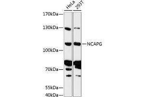 Western blot analysis of extracts of various cell lines, using NCAPG antibody (ABIN6130189, ABIN6144398, ABIN6144399 and ABIN6216998) at 1:3000 dilution. (NCAPG 抗体  (AA 610-700))