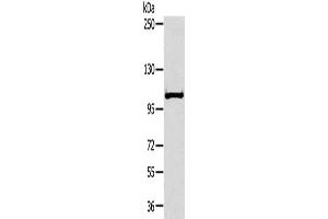 Gel: 6 % SDS-PAGE, Lysate: 40 μg, Lane: Mouse liver tissue, Primary antibody: ABIN7191695(NPR2 Antibody) at dilution 1/300, Secondary antibody: Goat anti rabbit IgG at 1/8000 dilution, Exposure time: 30 seconds (NPR2 抗体)
