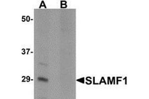 Western blot analysis of SLAMF1 in rat colon tissue lysate with SLAMF1 antibody at 1 μg/ml in (A) the absence and (B) the presence of blocking peptide (SLAMF1 抗体  (N-Term))