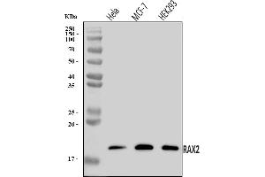 Western blot analysis of RAX2 using anti-RAX2 antibody (ABIN7602913).