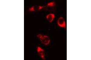 ABIN6276735 staining Hela cells by IF/ICC. (BTK 抗体  (Internal Region))