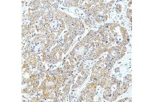 IHC analysis of ACSL4/FACL4 using anti-ACSL4/FACL4 antibody (ABIN7602756).
