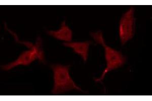 ABIN6267258 staining SK-OV3 by IF/ICC. (EGFR 抗体  (pThr678))