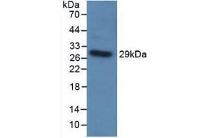 Western blot analysis of recombinant Human TLR5. (TLR5 抗体  (AA 303-514))