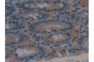 Immunohistochemistry (IHC) image for anti-ATP-Binding Cassette, Sub-Family C (CFTR/MRP), Member 1 (ABCC1) (AA 1219-1469) antibody (ABIN7440026)