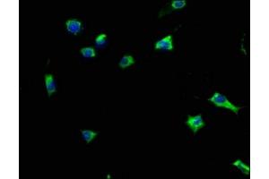 Immunofluorescence staining of SH-SY5Y cells with ABIN7162257 at 1:133, counter-stained with DAPI.