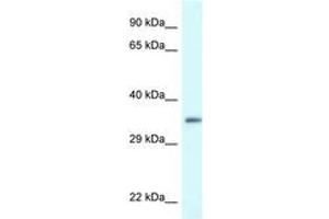 Image no. 1 for anti-PDZ and LIM Domain 1 (PDLIM1) (AA 216-265) antibody (ABIN6747329) (PDLIM1 抗体  (AA 216-265))