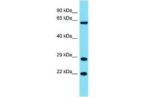 Host: Rabbit Target Name: FAM220A Sample Type: COLO205 Whole Cell lysates Antibody Dilution: 1. (Family with Sequence Similarity 220, Member A (FAM220A) (Middle Region) 抗体)